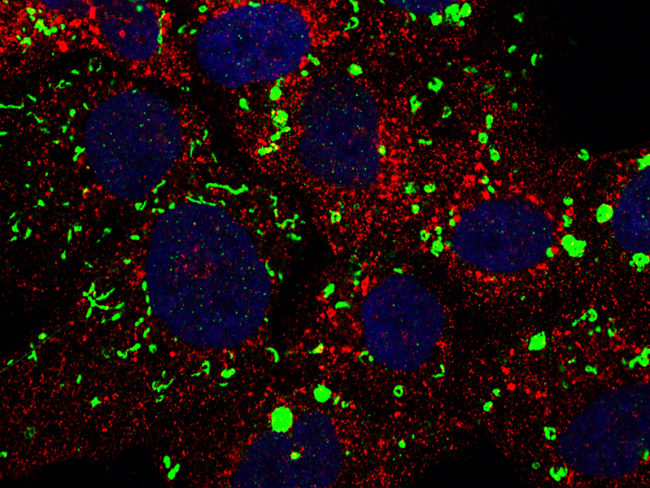ImageJ=1.51aunit=inch