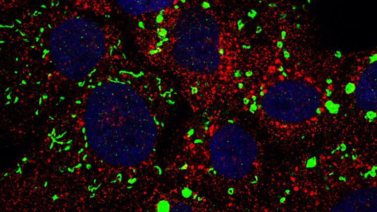 ImageJ=1.51aunit=inch