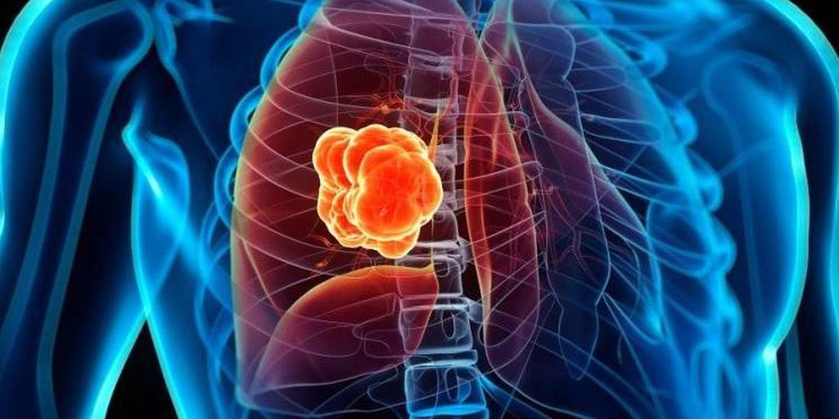 radioisotopos_cancer_microbacterium