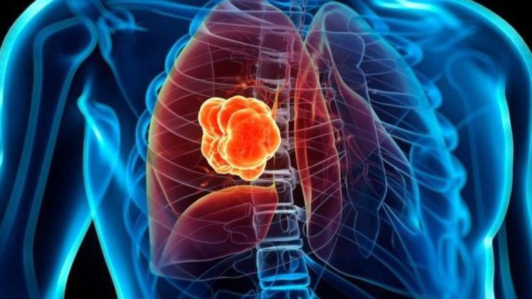 radioisotopos_cancer_microbacterium